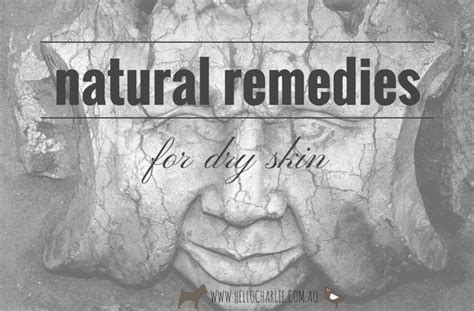 Natural Remedies For Dry Skin Hello Natural Living