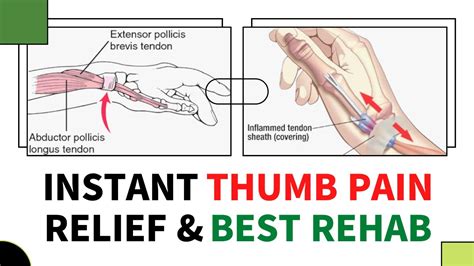 De Quervains Tenosynovitis Exercises By Mr Physio Wrist Thumb Pain