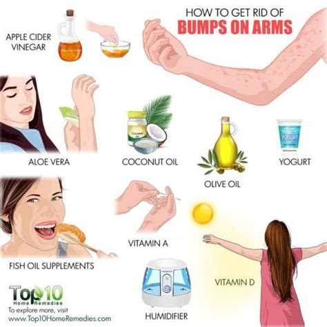 How To Get Rid Of Bumps On Arms Bumps On Arms Skin Bumps Treating