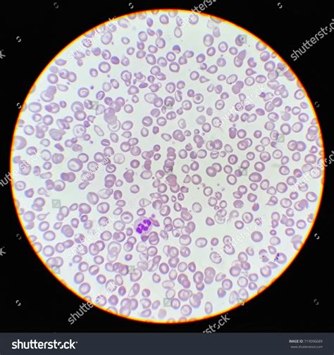 Human Blood Smear Under 100x Light Stock Photo 719096689 Shutterstock