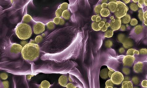 Bactéria Fungos E Vírus São Agentes Causadores De Diversas Patologias
