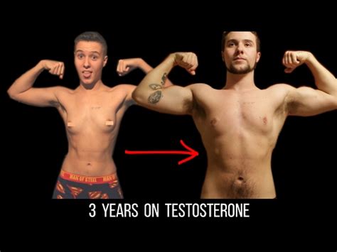 Female To Male Transition 3 Years On Testosterone YouTube