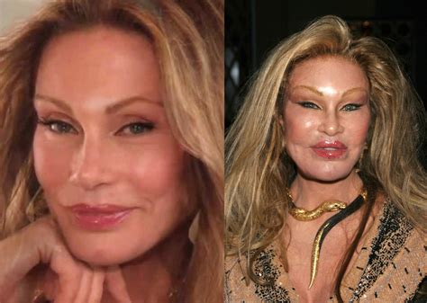 Most Expensive Celebrity Plastic Surgeries Ever And How Much They Cost