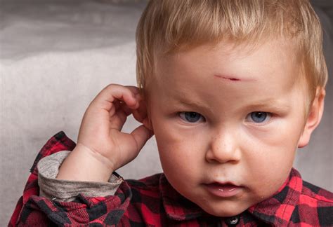 Head Injury In Children Types Symptoms And Treatment