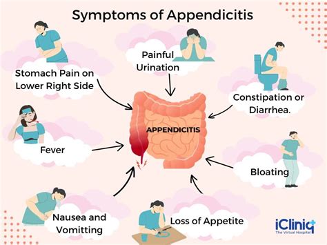 Appendix Pain Location