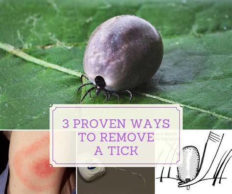 3 Proven Ways To Remove A Tick Home And Gardening Ideas