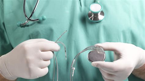 8 Tips To Prepare For A Pacemaker Insertion Pacemaker Precautions
