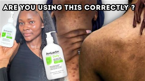 How To Properly Use The Amlactin Body Lotion Tips On How To Get