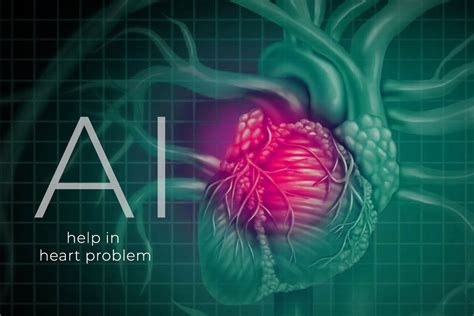 Artificial Intelligence Might Helpful To Detect Heart Problems