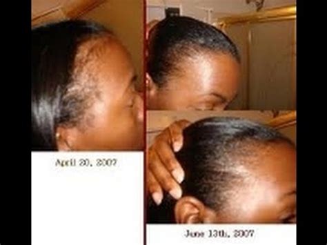 New (2) from $11.49 & free shipping on. Before You Use Potent Jamaican Black Castor Oil BENEFITS ...