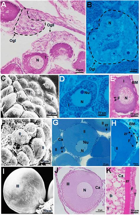 Morphology Of Oocyte Types In Hypancistrus Zebra Ab Oogonia Nest