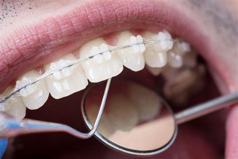 Nhs Orthodontic Services Will Get Treatment From New Provider The