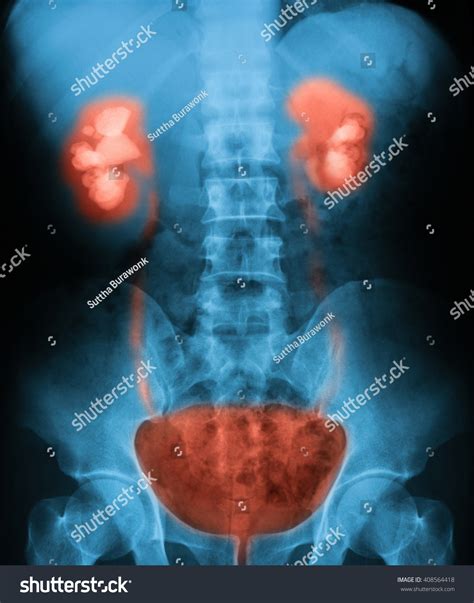 Maybe you would like to learn more about one of these? Edit Images Free Online - X-ray image | Shutterstock Editor
