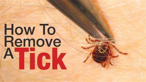 Remove Ticks From Cats Uk Cat Meme Stock Pictures And Photos