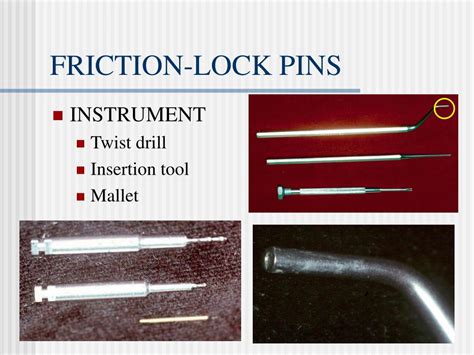 Ppt Use Of Dental Pin Powerpoint Presentation Free Download Id901756