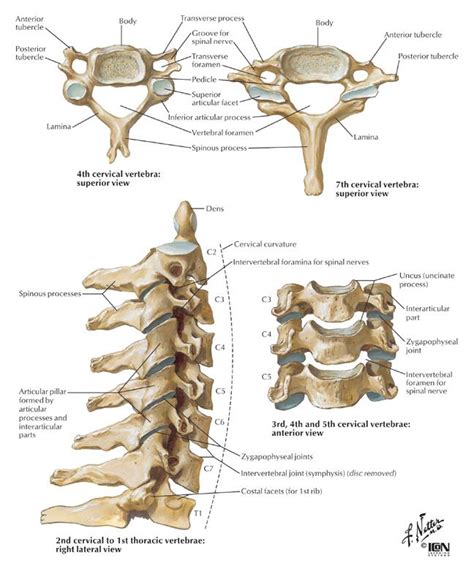 In this procedure, the surgeon inserts a catheter into the compressed vertebra. Head and C-Spine Injuries at Emory University - StudyBlue
