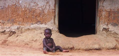 Kwashiorkor A Critical And Global Issue Borgen