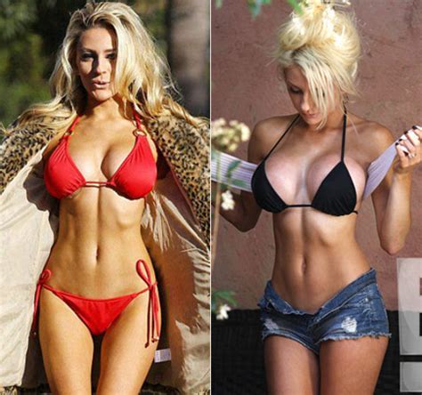 PHOTOS Courtney Stodden Before And After Breast Implants Surgery