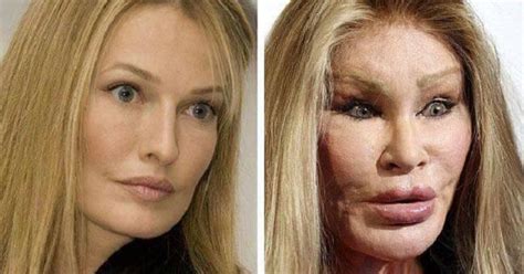 Kim Novak Plastic Surgery Gone Wrong Viral Gala