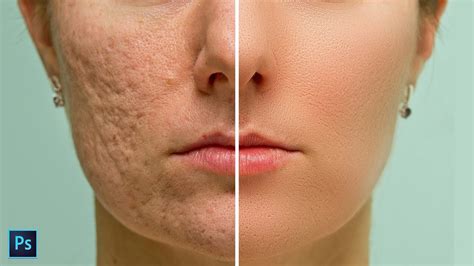 High End Skin Softening In Photoshop Remove Blemishes Wrinkles Acne