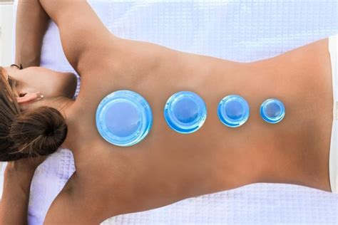 Cupping Therapy Explained Meadows Holistic Therapies