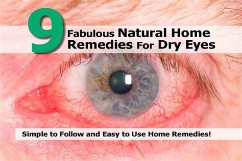 9 Fabulous Natural Home Remedies For Dry Eyes