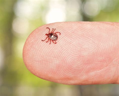 Red Meat Allergy How One Tick Bite Can Upend Your Diet And Your Life