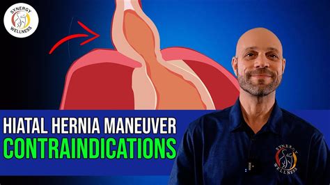 Contraindications To Having The Hiatal Hernia Maneuver Done Youtube