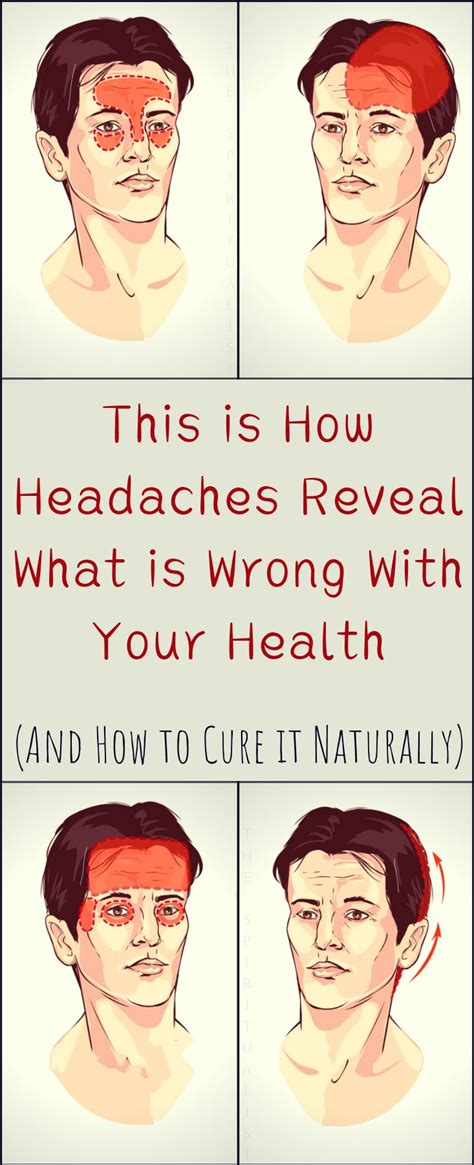 This Is How Headaches Reveal What Is Wrong With Your Health And How To