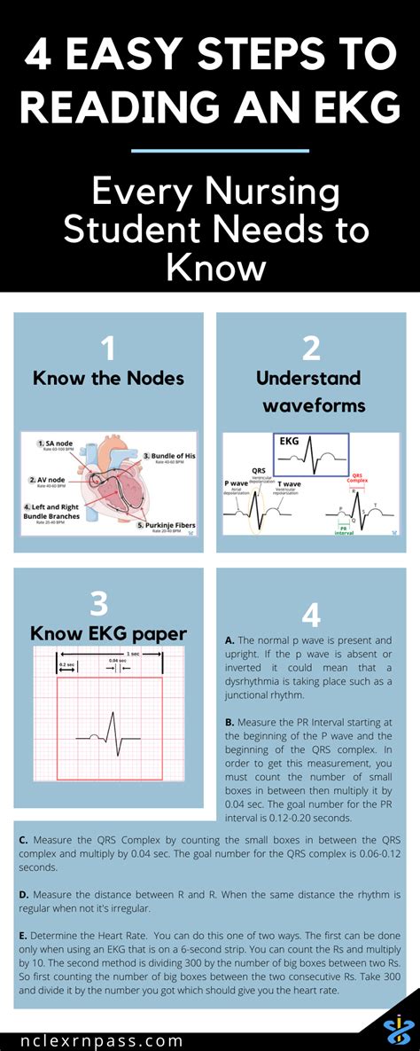 Nclex Rn Pass Ekgs Made Easy How To Start Reading Rhythm Strips