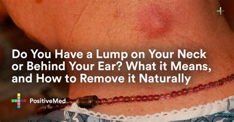 Do You Have A Lump On Your Neck Or Behind Your Ear What It Means And