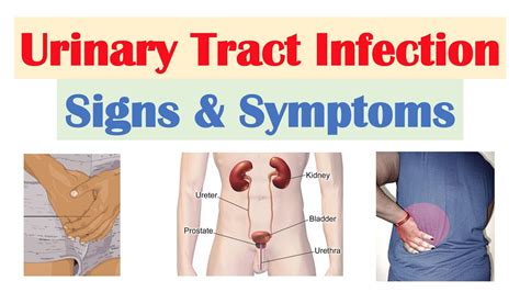 Urinary Tract Infection UTI Signs Symptoms Why They Occur YouTube