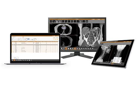 Pacs And Diagnostic Imaging Workstation Paxeraview Paxerahealth