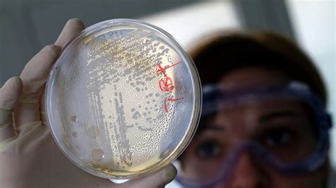 Researchers Find First Us Bacteria With Worrisome Superbug Genes