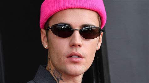 Justin Bieber Battling Virus That Has Paralyzed Half His Face
