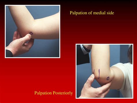 Ppt Physical Examination Of The Elbow Powerpoint Presentation Free