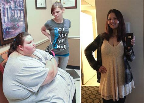 amazing before and after weight loss photos from women who were morbidly obese