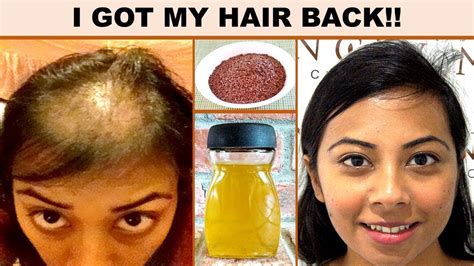 Fast Hair Growth Serum All Natural Apply To Hair Roots To Get Tremendous Hair Growth Fast
