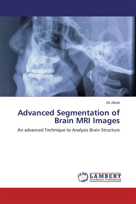 Advanced Segmentation Of Brain Mri Images 978 3 8473 4574 9