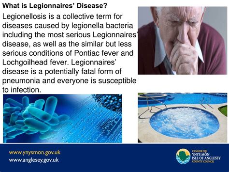 Ppt Legionnaires Disease Powerpoint Presentation Free Download Id