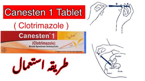 How To Use Canesten 1 Tablet Clotrimazole Fungal Infection Yeast Infection Youtube