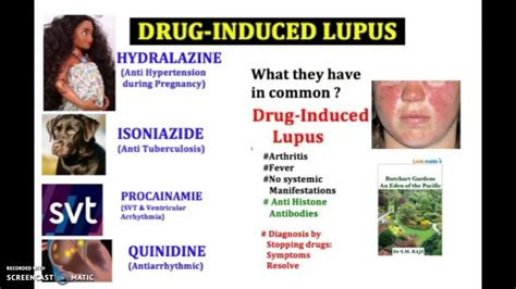 Drug Induced Lupus Causes