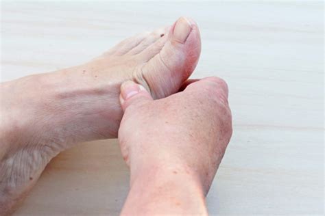 Gout Symptoms Foot Pain Especially In Your Big Toe Is A Sign