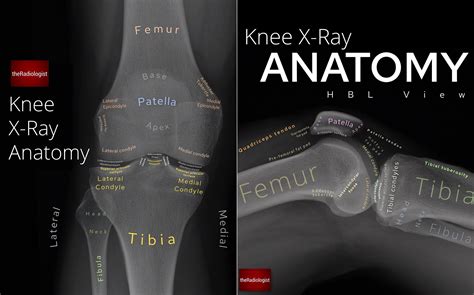 Pelvic X Ray Anatomy And Interpretation Checklist Gre