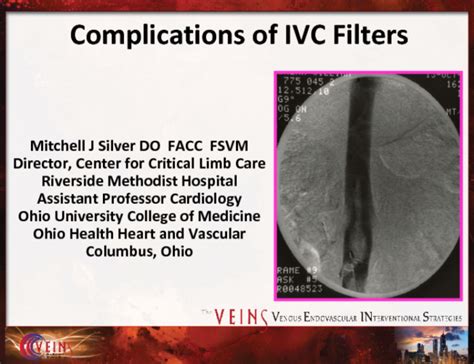 Complications Of Ivc Filters
