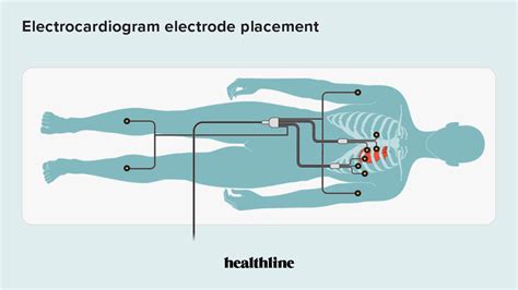 Electrocardiogram Procedure Risks And Results