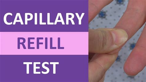 capillary refill time test normal vs abnormal nursing clinical skills youtube