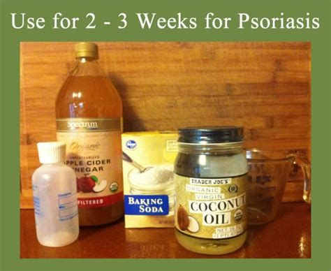 Homemade Natural Psoriasis Shampoo Remedygrove