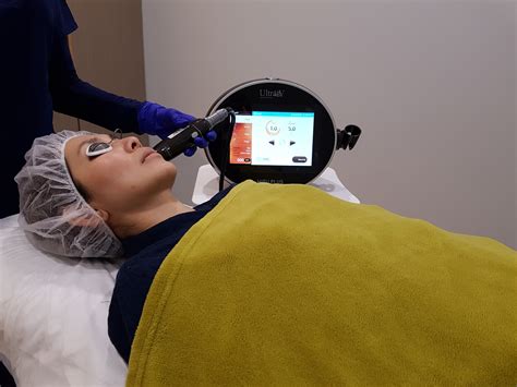 Give Yourself A Much Needed Lift With The Ultra V HIFU ...