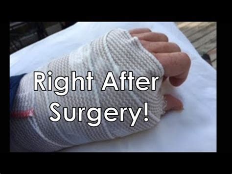 Basal Joint Arthritis After Surgery On Surgery Day Youtube